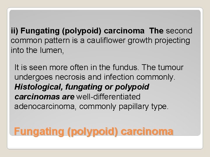 ii) Fungating (polypoid) carcinoma The second common pattern is a cauliflower growth projecting into