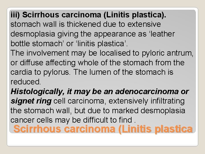 iii) Scirrhous carcinoma (Linitis plastica). stomach wall is thickened due to extensive desmoplasia giving