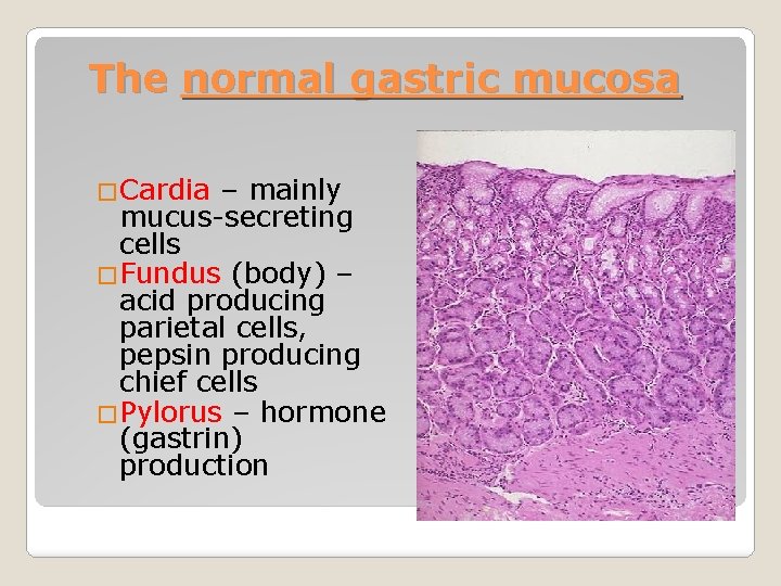 The normal gastric mucosa �Cardia – mainly mucus-secreting cells �Fundus (body) – acid producing