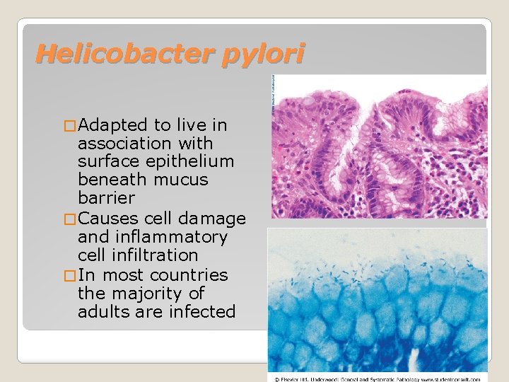 Helicobacter pylori � Adapted to live in association with surface epithelium beneath mucus barrier