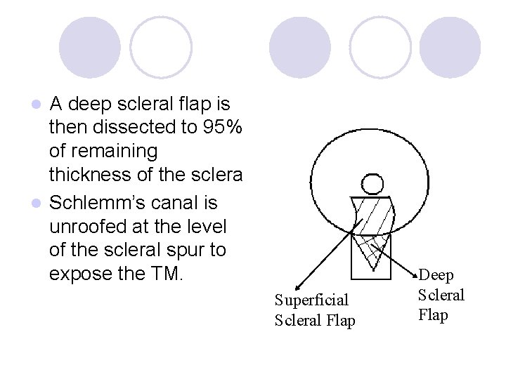 A deep scleral flap is then dissected to 95% of remaining thickness of the