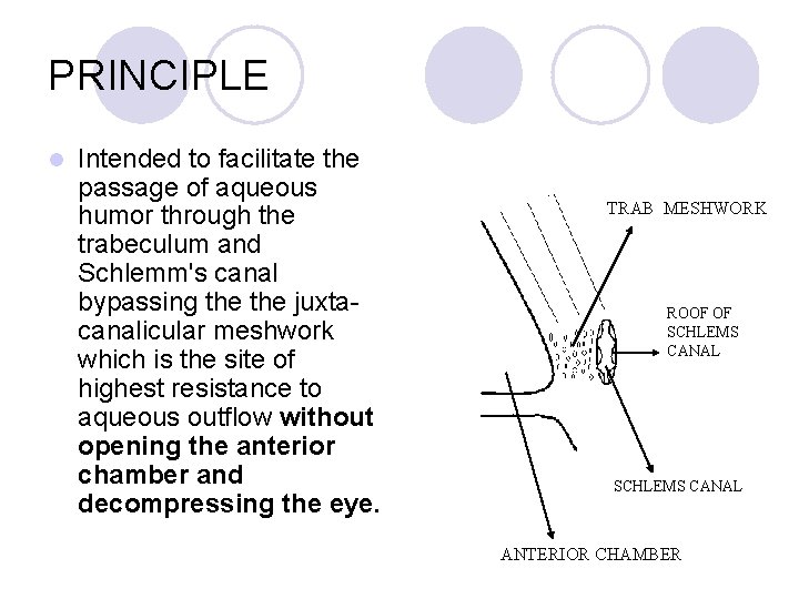 PRINCIPLE l Intended to facilitate the passage of aqueous humor through the trabeculum and