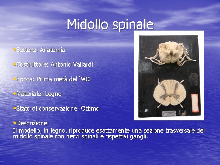 Midollo spinale • Settore: Anatomia • Costruttore: Antonio Vallardi • Epoca: Prima metà del