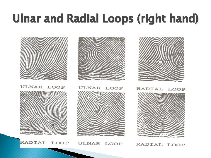 Ulnar and Radial Loops (right hand) 