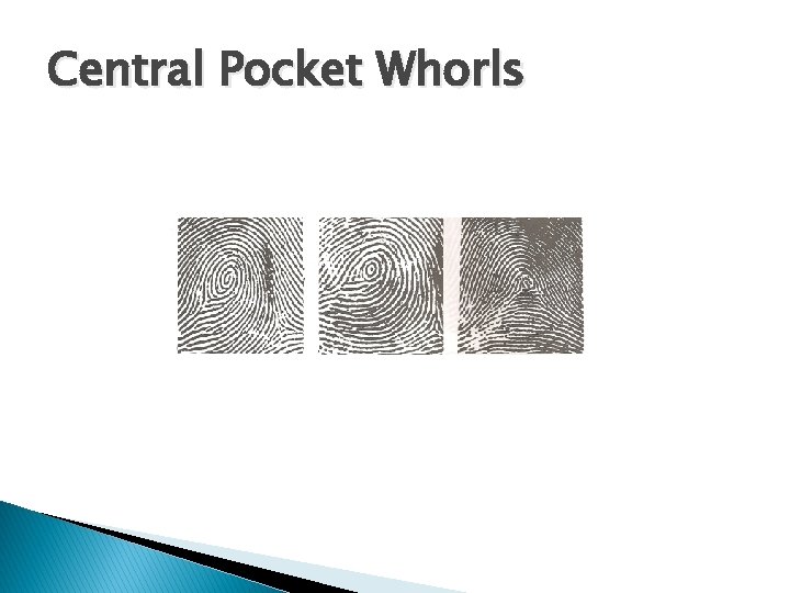 Central Pocket Whorls 