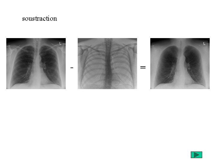 soustraction - = 