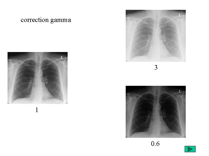 correction gamma 3 1 0. 6 