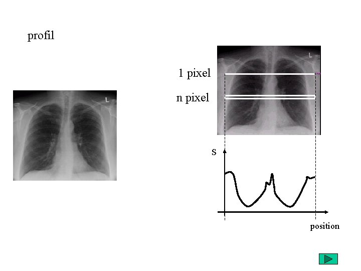 profil 1 pixel n pixel S position 