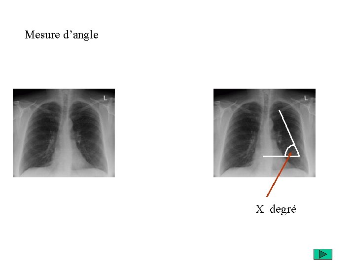 Mesure d’angle X degré 