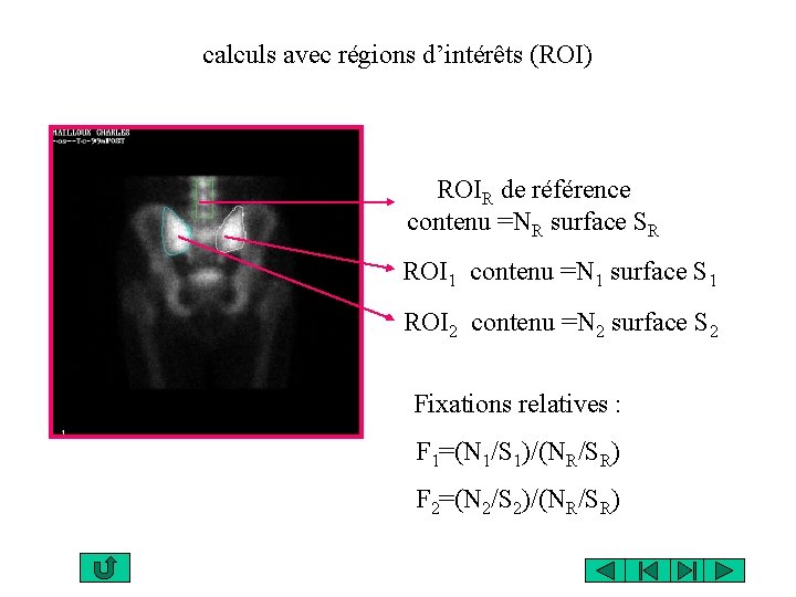 calculs avec régions d’intérêts (ROI) ROIR de référence contenu =NR surface SR ROI 1