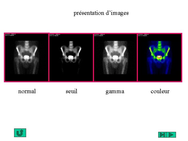 présentation d’images normal seuil gamma couleur 