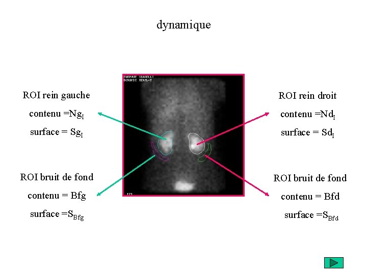 dynamique ROI rein gauche ROI rein droit contenu =Ng. I contenu =Nd. I surface