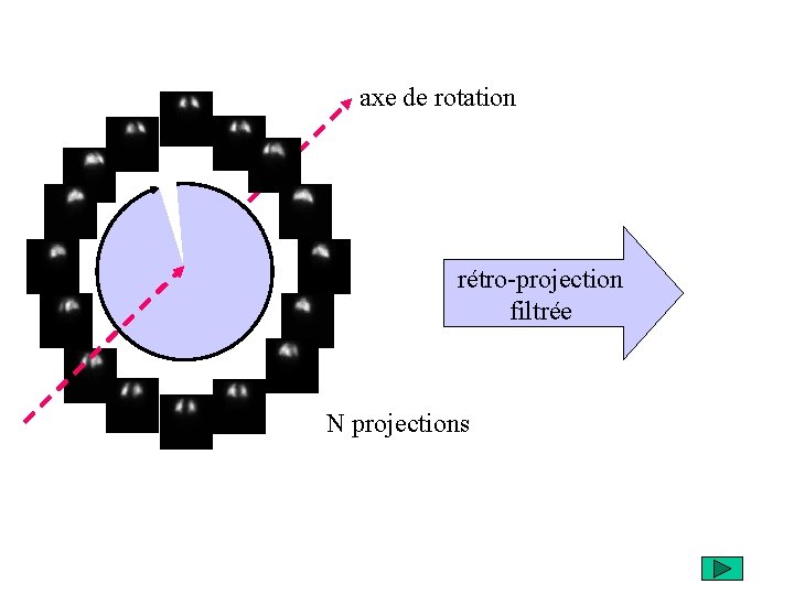 axe de rotation rétro-projection filtrée N projections 