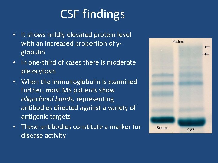 CSF findings • It shows mildly elevated protein level with an increased proportion of