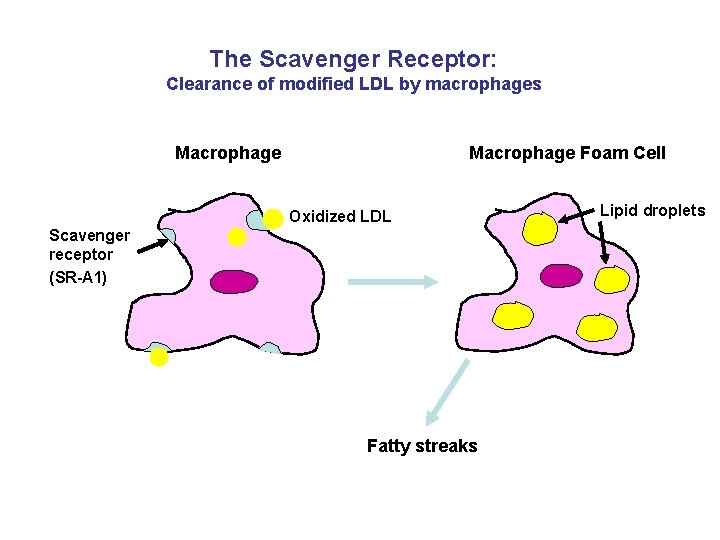 The Scavenger Receptor: Clearance of modified LDL by macrophages Macrophage Foam Cell Oxidized LDL