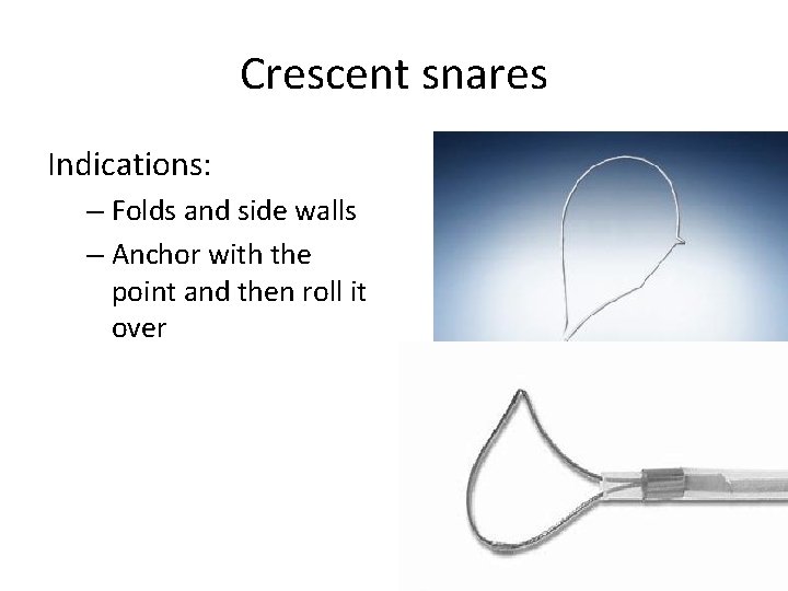 Crescent snares Indications: – Folds and side walls – Anchor with the point and