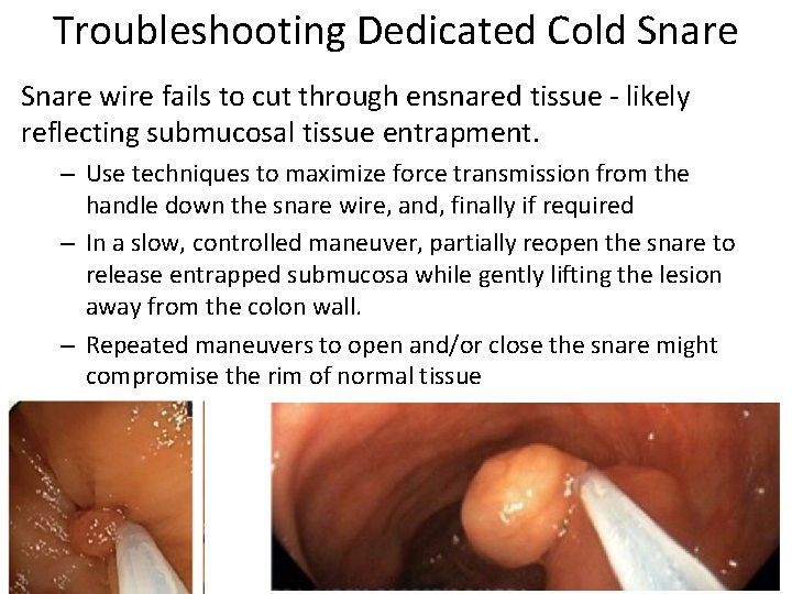 Troubleshooting Dedicated Cold Snare wire fails to cut through ensnared tissue - likely reflecting