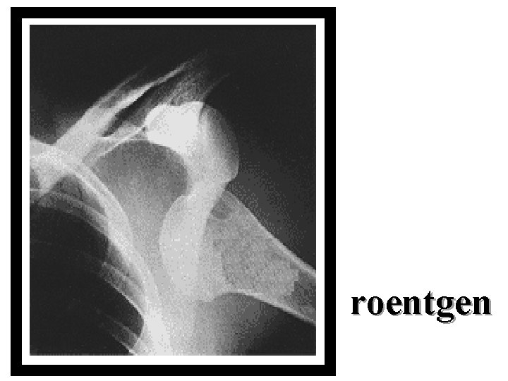 roentgen 