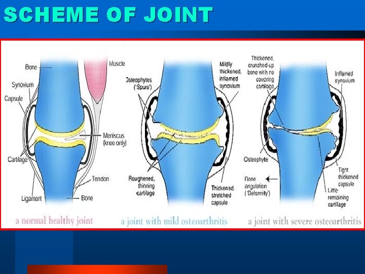 SCHEME OF JOINT 