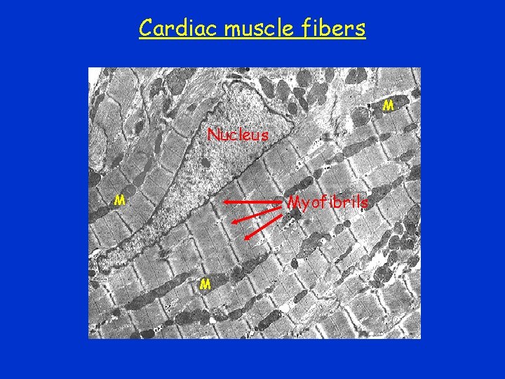 Cardiac muscle fibers M Nucleus Myofibrils M M Cardiac muscle fibers M Nucleus Myofibrils M M