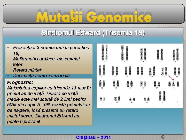 Mutaţii Genomice Sindromul Edward (Trisomia 18) • Prezenţa a 3 cromozomi în perechea 18;