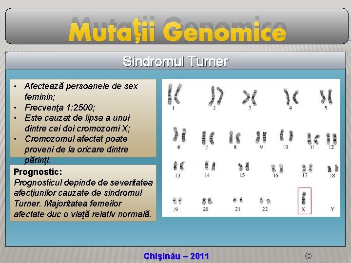 Mutații Genomice Sindromul Turner • Afectează persoanele de sex feminin; • Frecvenţa 1: 2500;