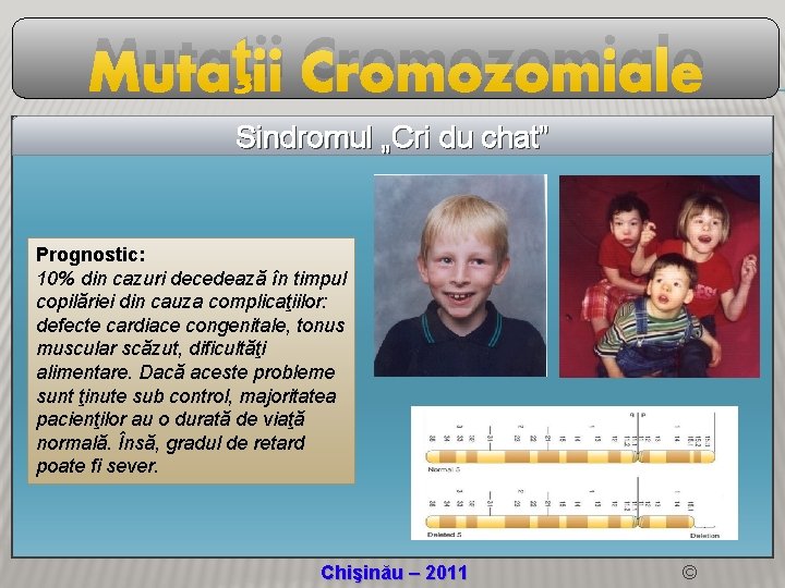 Mutaţii Cromozomiale Sindromul „Cri du chat” Prognostic: 10% din cazuri decedează în timpul copilăriei