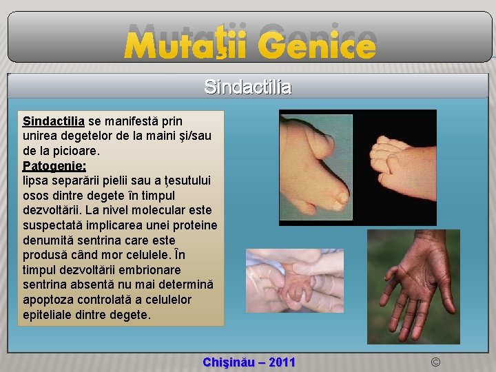 Mutaţii Genice Sindactilia se manifestă prin unirea degetelor de la maini şi/sau de la Mutaţii Genice Sindactilia se manifestă prin unirea degetelor de la maini şi/sau de la
