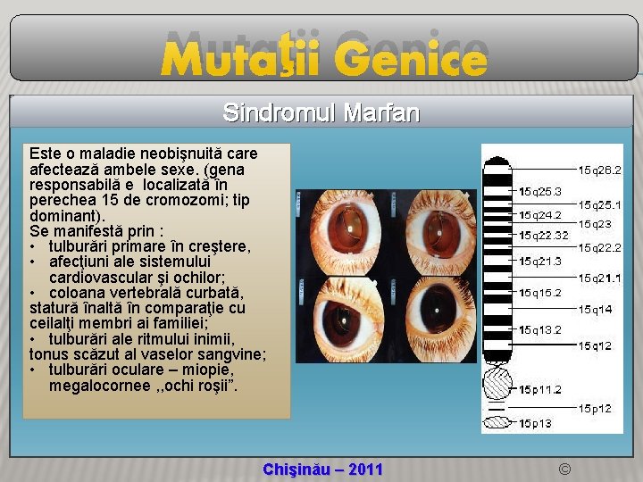 Mutaţii Genice Sindromul Marfan Este o maladie neobişnuită care afectează ambele sexe. (gena responsabilă