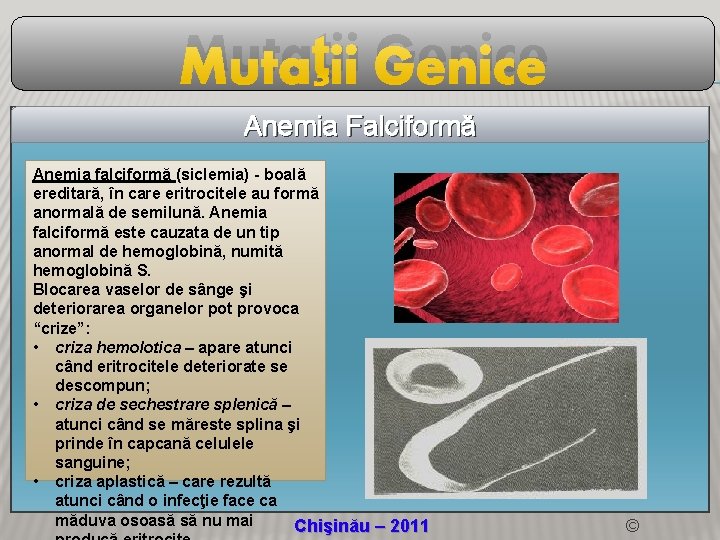 Mutaţii Genice Anemia Falciformă Anemia falciformă (siclemia) - boală ereditară, în care eritrocitele au Mutaţii Genice Anemia Falciformă Anemia falciformă (siclemia) - boală ereditară, în care eritrocitele au