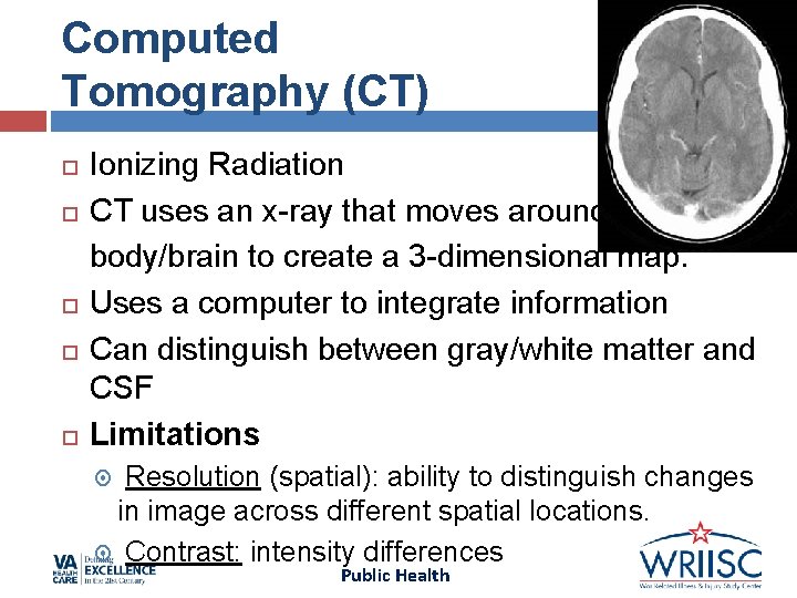 Computed Tomography (CT) Ionizing Radiation CT uses an x-ray that moves around body/brain to Computed Tomography (CT) Ionizing Radiation CT uses an x-ray that moves around body/brain to