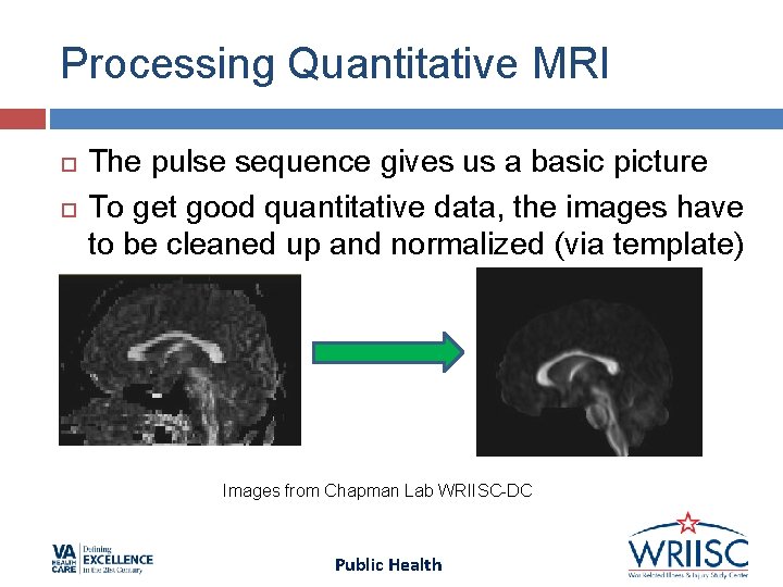 Processing Quantitative MRI The pulse sequence gives us a basic picture To get good Processing Quantitative MRI The pulse sequence gives us a basic picture To get good