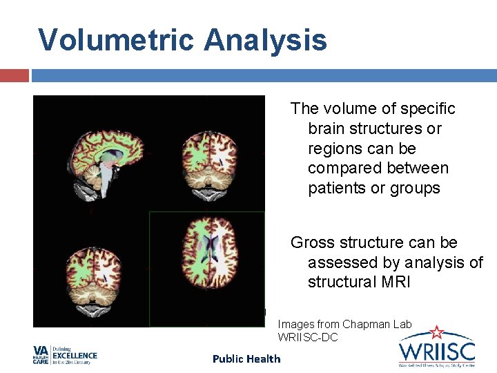 Volumetric Analysis The volume of specific brain structures or regions can be compared between Volumetric Analysis The volume of specific brain structures or regions can be compared between
