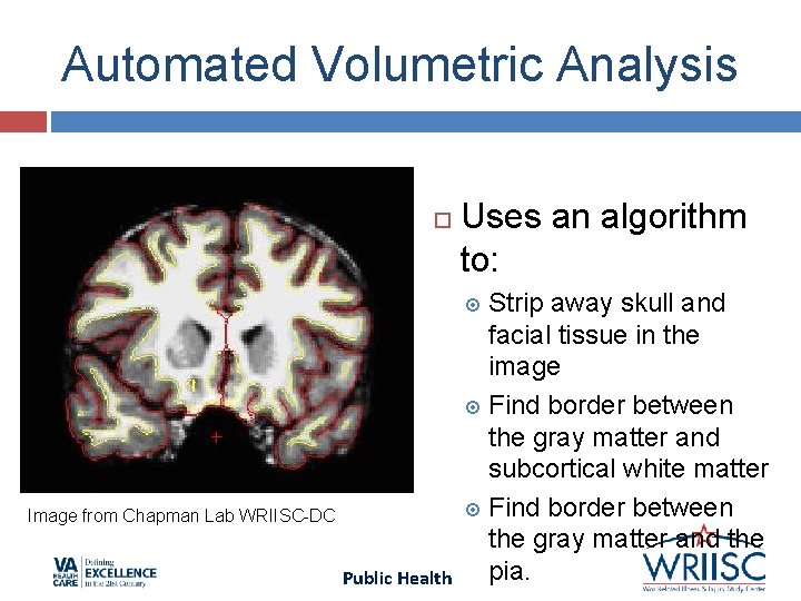 Automated Volumetric Analysis Uses an algorithm to: Strip away skull and facial tissue in Automated Volumetric Analysis Uses an algorithm to: Strip away skull and facial tissue in
