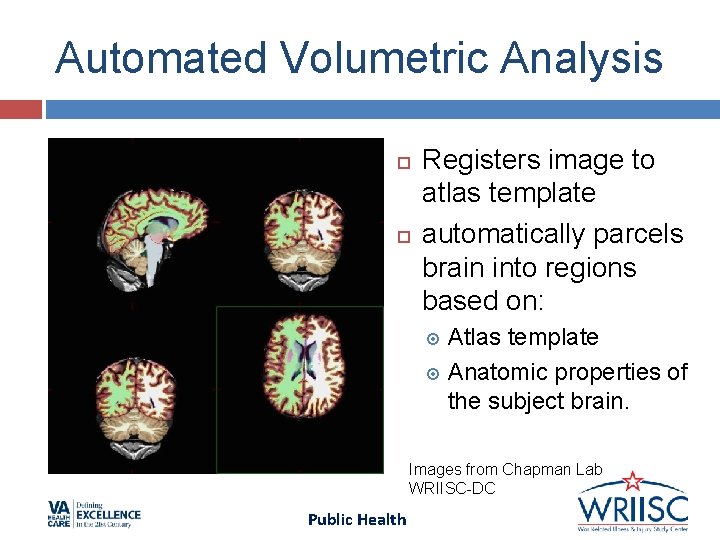 Automated Volumetric Analysis Registers image to atlas template automatically parcels brain into regions based Automated Volumetric Analysis Registers image to atlas template automatically parcels brain into regions based