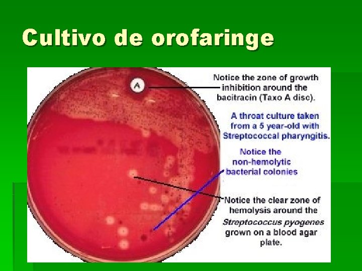 Cultivo de orofaringe 