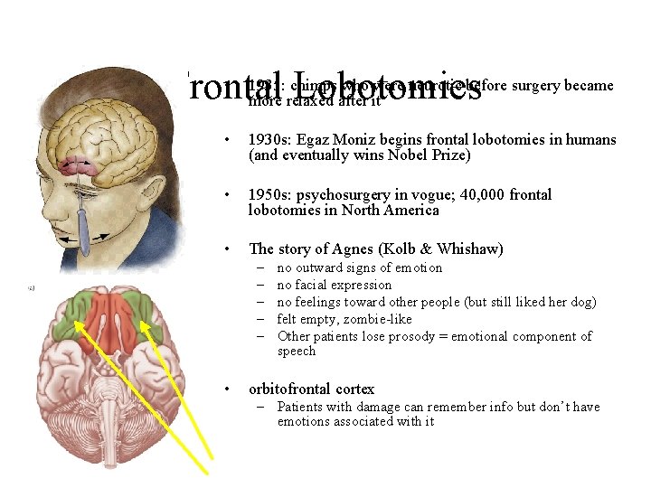  • 1935: chimps who were neurotic before surgery became Frontal Lobotomies more relaxed