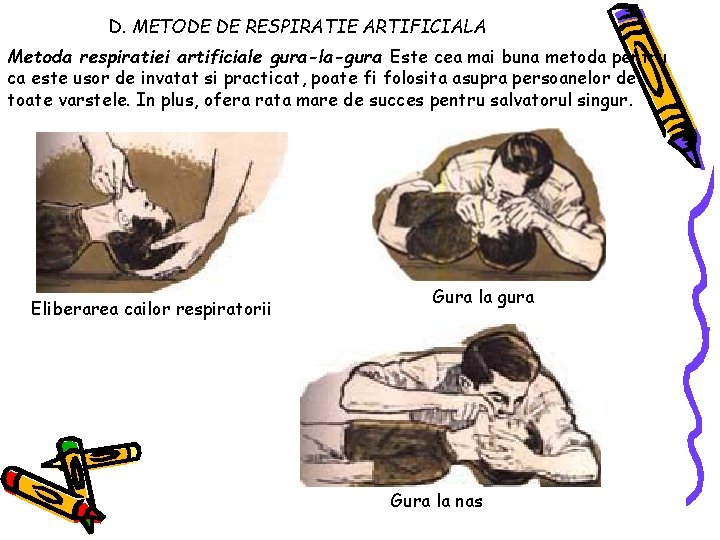 D. METODE DE RESPIRATIE ARTIFICIALA Metoda respiratiei artificiale gura-la-gura Este cea mai buna metoda