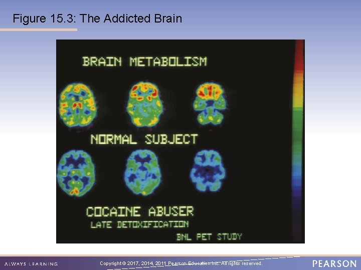 Figure 15. 3: The Addicted Brain Copyright © 2017, 2014, 2011 Pearson Education Inc.