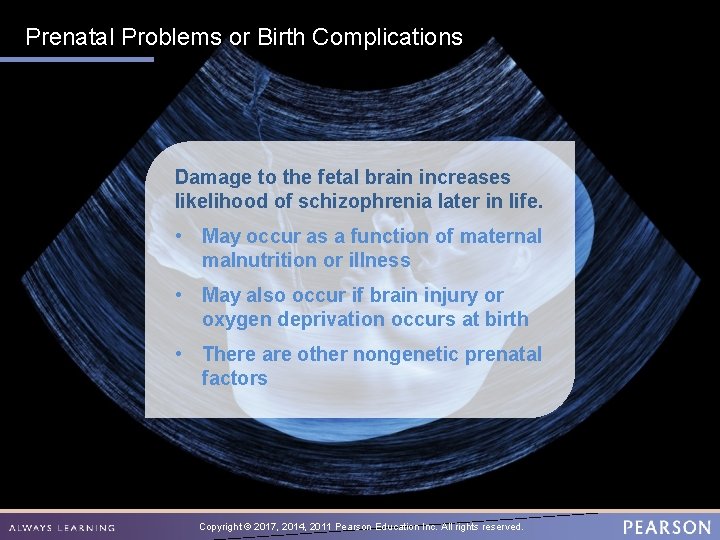 Prenatal Problems or Birth Complications Damage to the fetal brain increases likelihood of schizophrenia