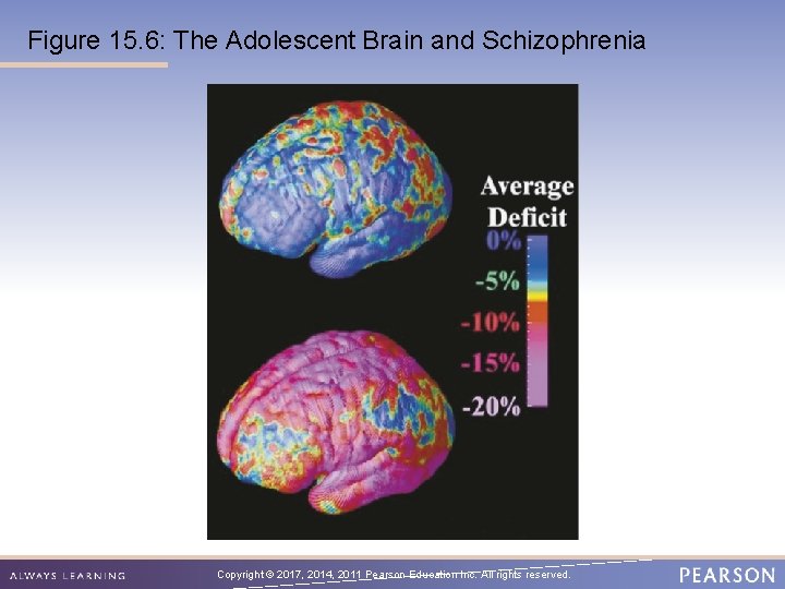 Figure 15. 6: The Adolescent Brain and Schizophrenia Copyright © 2017, 2014, 2011 Pearson
