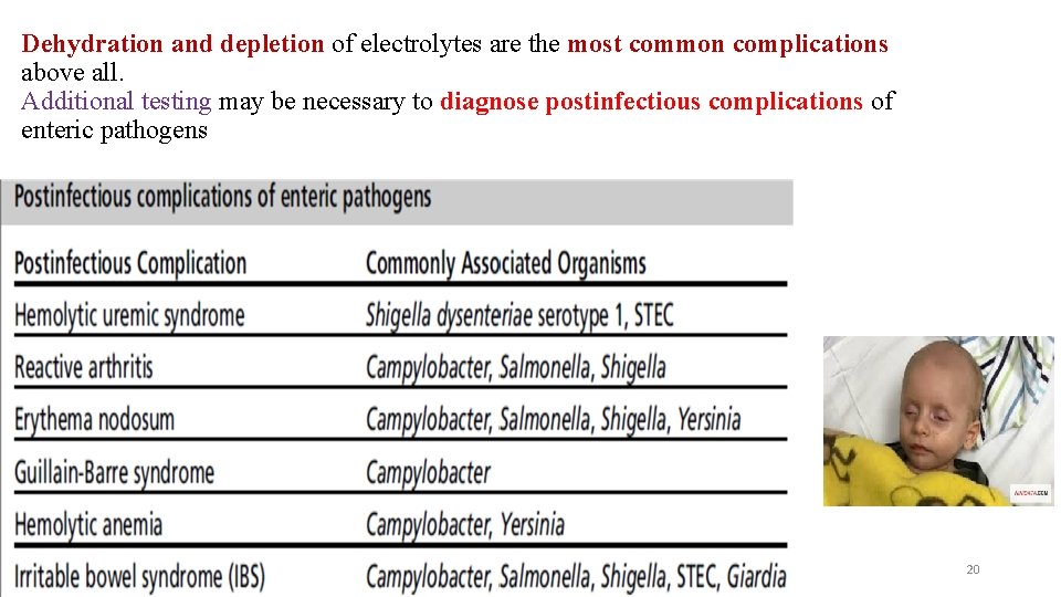  Dehydration and depletion of electrolytes are the most common complications above all. Additional