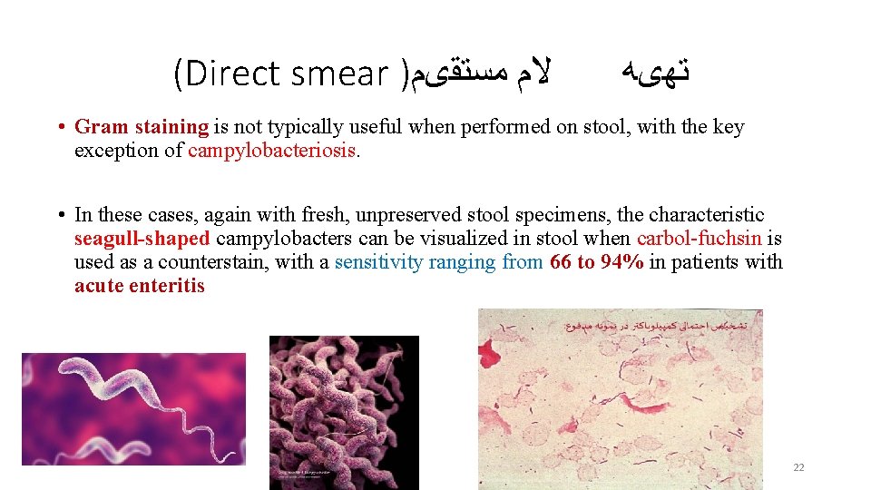 (Direct smear ) ﻣﺴﺘﻘیﻢ ﻻﻡ ﺗﻬیﻪ • Gram staining is not typically useful when