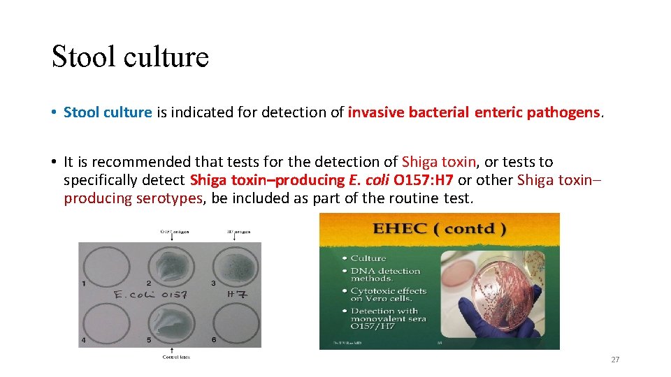 Stool culture • Stool culture is indicated for detection of invasive bacterial enteric pathogens.