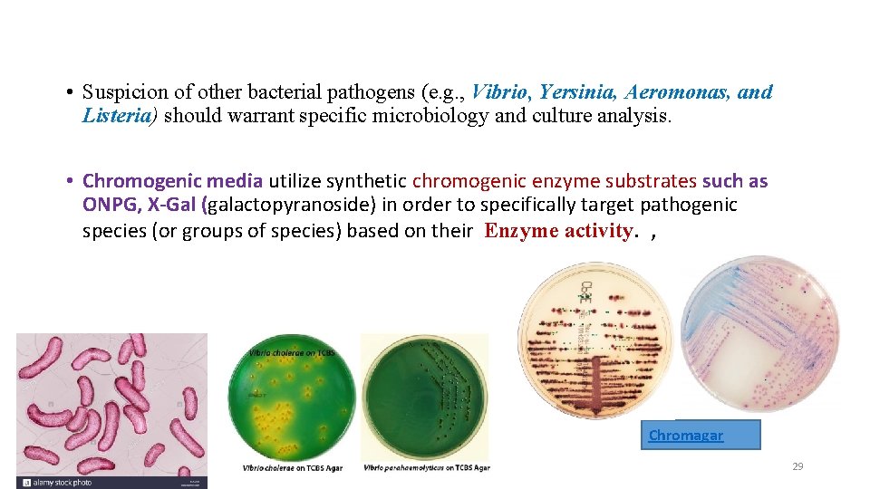  • Suspicion of other bacterial pathogens (e. g. , Vibrio, Yersinia, Aeromonas, and