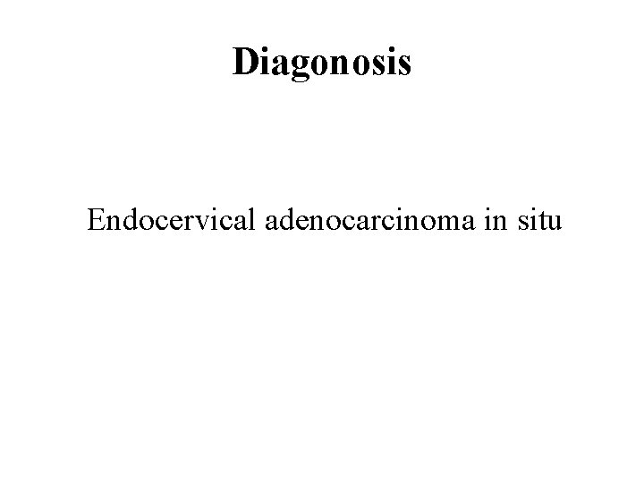 Diagonosis Endocervical adenocarcinoma in situ 