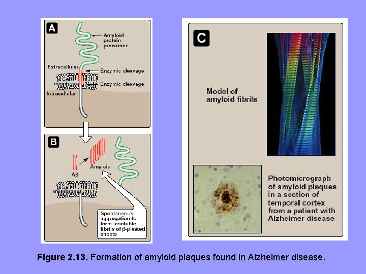 Figure 2. 13. Formation of amyloid plaques found in Alzheimer disease. 
