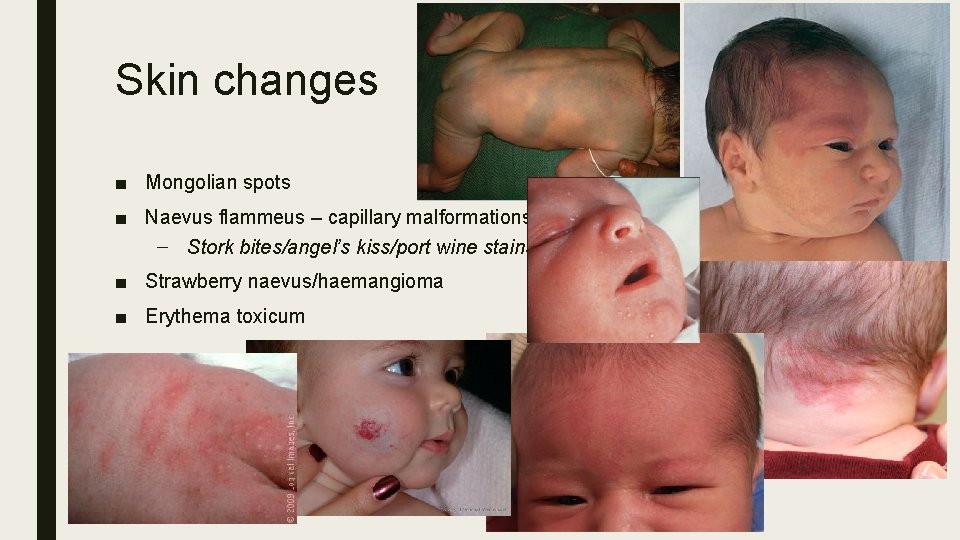 Newborn Baby Check Isabel Ng Introduction Wiper Gloves Newborn Baby Check Isabel Ng Introduction Wiper Gloves