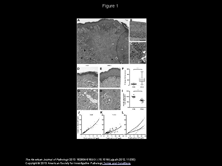 Figure 1 The American Journal of Pathology 2013 182806 -818 DOI: (10. 1016/j. ajpath.