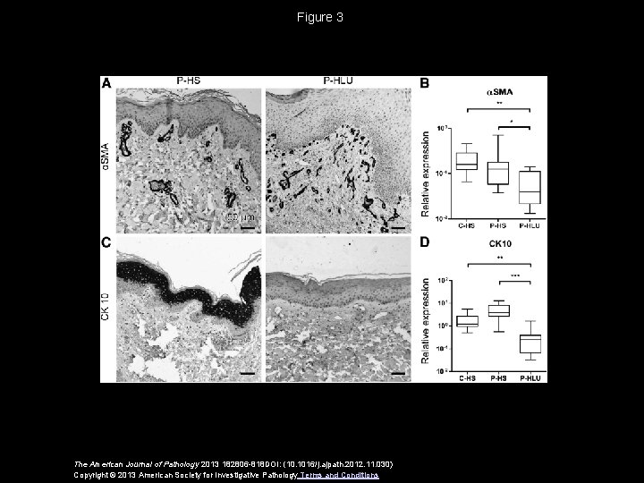 Figure 3 The American Journal of Pathology 2013 182806 -818 DOI: (10. 1016/j. ajpath.